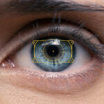 ICL (Implantable Collamer Lens) in Encinitas Haug Optometry