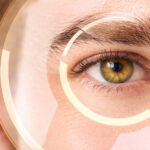 LASIK in Encinitas Haug Optometry