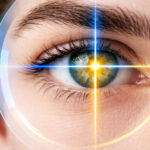 SMILE (Small Incision Lenticule Extraction) in Encinitas Haug Optometry